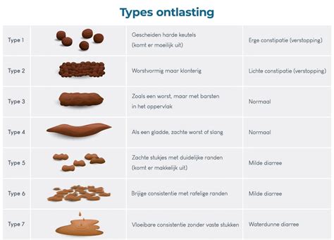 Schema met de verschillende soorten nierstenen en hun oorzaken