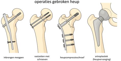 Symbolische weergave van de gebroken kop van een slang en een hiel die geneest.